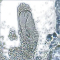 Wurmmittel  Parasitenmittel Karpfenlaus Tomodachi Wurmfrei Pro Cyromazin  1L für 50.000L Teiche